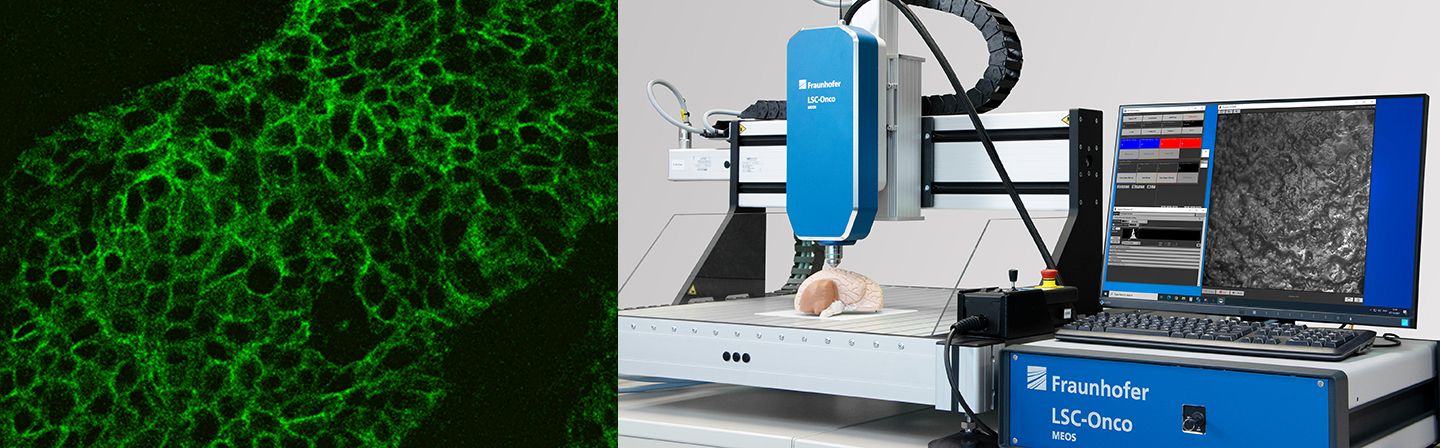 Abbildung des am Fraunhofer MEOS entwickelten Laser-Scanning-Mikroskops zur nicht-invasiven intraoperativen Tumordiagnostik sowie eine damit analysierte, EpCAM-markierte Tumorprobe 