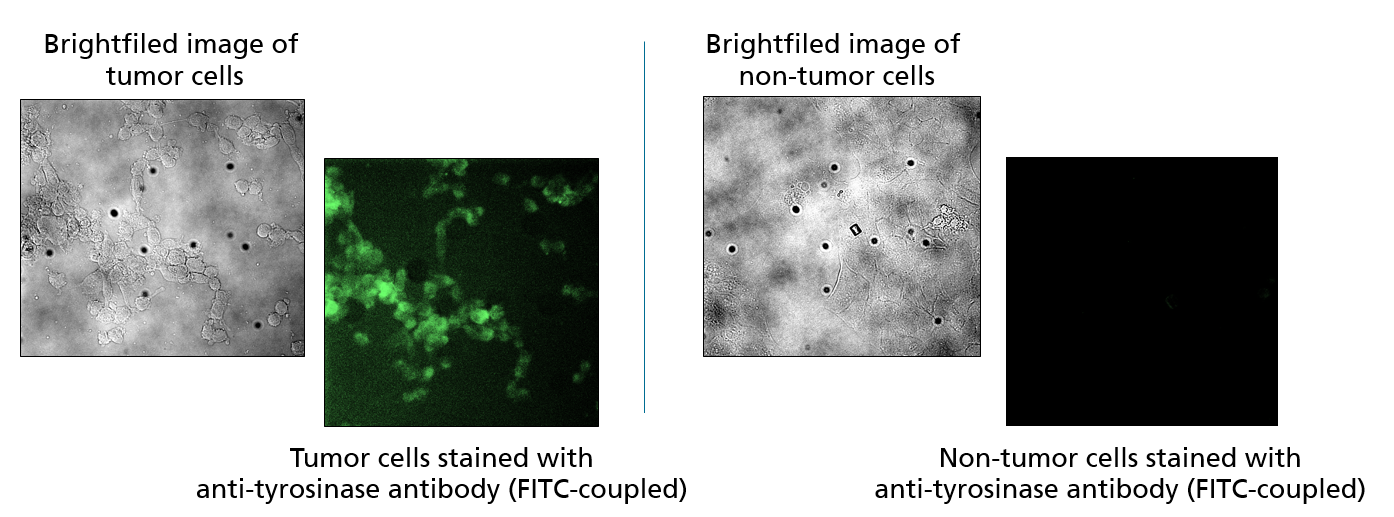 Specific staining of tumor tissue with fluorescein isothyocyanate (FITC)-coupled antibodies